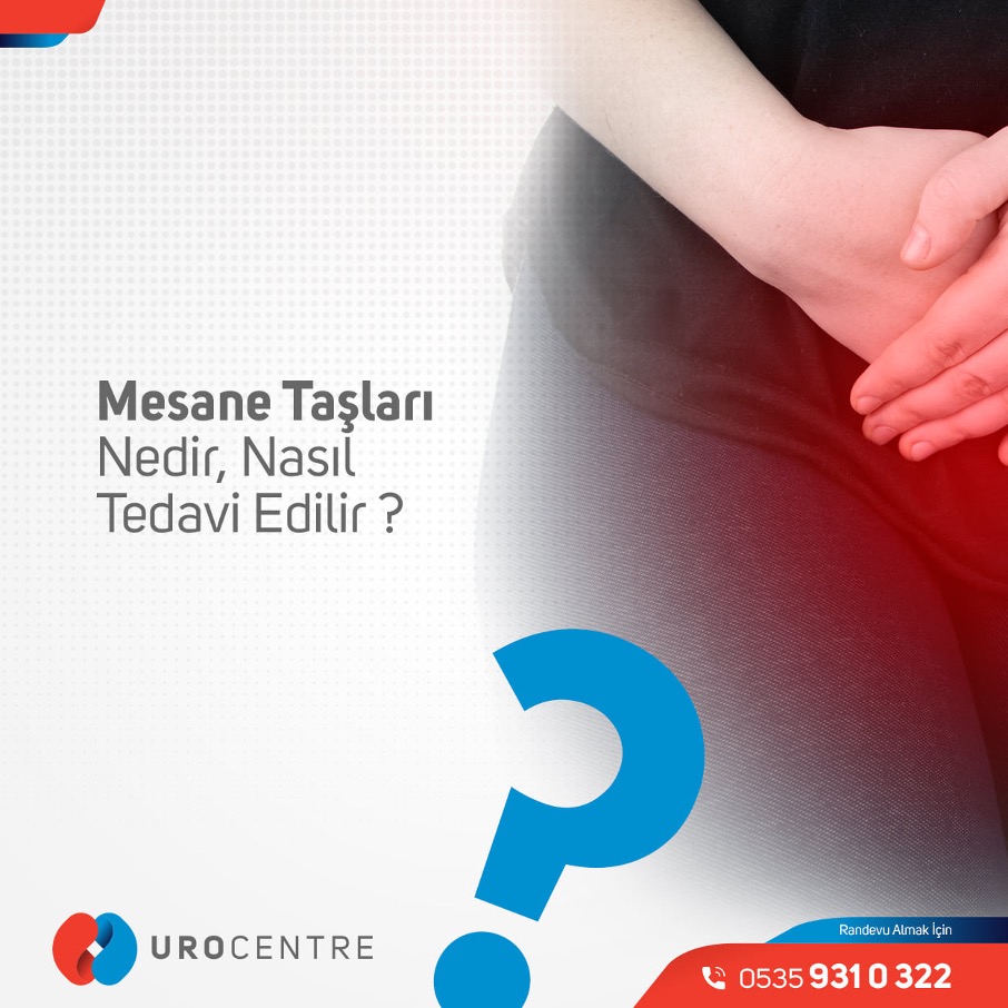 MESANE TAŞLARI