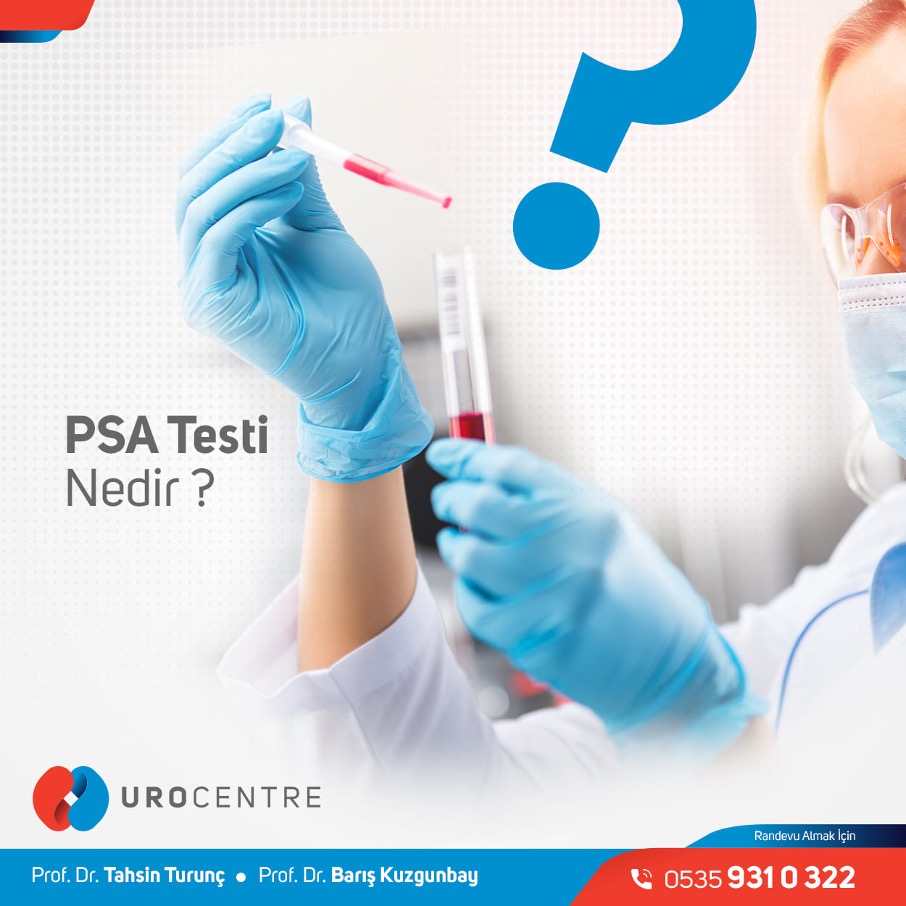 PSA TESTİ