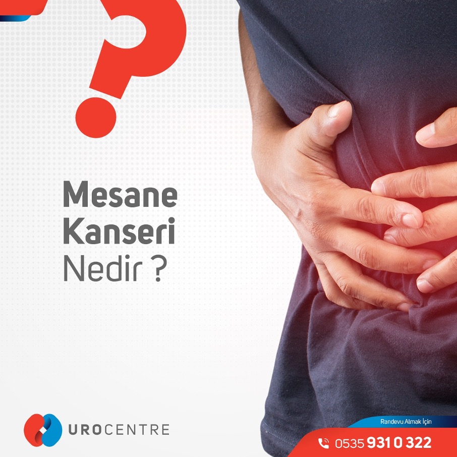 MESANE KANSERİ